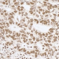 Phospho-RPA32 (Ser4, Ser8) Rabbit anti-Human, Mouse, Polyclonal, Bethyl