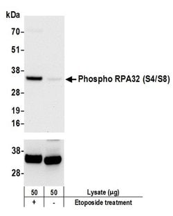 Phospho-RPA32 (Ser4, Ser8) Polyclonal Antibody, Bethyl Laboratories 20