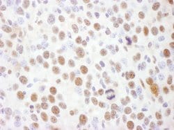 Phospho-Rad17 (Ser645) Rabbit anti-Human, Mouse, Polyclonal, Bethyl Laboratories