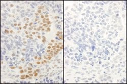 Phospho-RelA (Ser536) Polyclonal Antibody, Bethyl Laboratories 100 &mu;L;