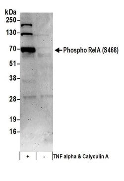 Phospho-RelA (Ser468) Polyclonal Antibody, Bethyl Laboratories:Antibodies:Primary