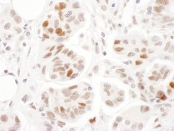 Phospho-SMC1 (Ser957) Rabbit anti-Human, Mouse, Polyclonal, Bethyl Laboratories
