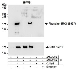 Phospho-SMC1 (Ser957) Rabbit anti-Human, Mouse, Polyclonal, Bethyl Laboratories