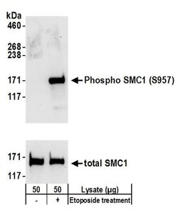 Phospho-SMC1 (Ser957) Rabbit anti-Human, Mouse, Polyclonal, Bethyl Laboratories