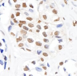Phospho-SMC1 (Ser966) Rabbit anti-Human, Polyclonal, Bethyl Laboratories