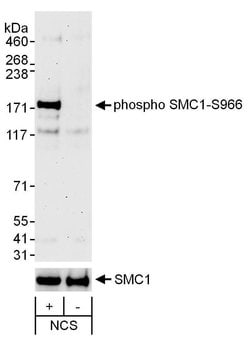 Phospho-SMC1 (Ser966) Polyclonal Antibody, Bethyl Laboratories 20 &mu;L;