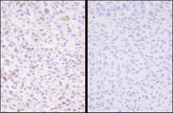 Phospho-SMC3 (Ser1083) Polyclonal Antibody, Bethyl Laboratories 10 &mu;L;