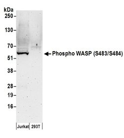 Phospho-WASP (Ser483, Ser484) Polyclonal Antibody, Bethyl Laboratories:Antibodies:Primary