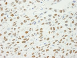 Phospho-XRCC1 (Ser461) Polyclonal Antibody, Bethyl Laboratories 100 &mu;L;