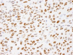 Phospho-XRCC1 (Ser485,Thr488) Polyclonal Antibody, Bethyl Laboratories