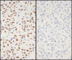 Phospho-XRCC1 (Ser518, Thr519, Thr523) Polyclonal Antibody, Bethyl Laboratories