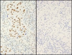Phospho-XRCC1 (Ser518, Thr519, Thr523) Polyclonal Antibody, Bethyl Laboratories
