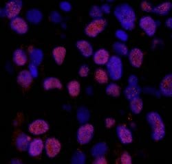 Phospho-XRCC1 (Ser518, Thr519, Thr523) Polyclonal Antibody, Bethyl Laboratories