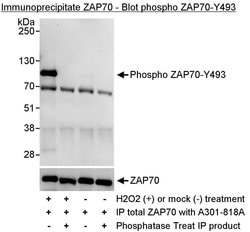 Phospho-ZAP70 (Tyr493) Rabbit anti-Human, Polyclonal, Bethyl Laboratories