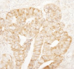 rpL7a/SURF3 Polyclonal Antibody, Bethyl Laboratories:Antibodies:Primary