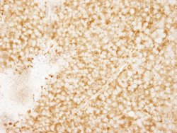 rpL7a/SURF3 Polyclonal Antibody, Bethyl Laboratories 10 &mu;L; Unconjugated:Antibodies,