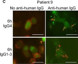 Invitrogen Goat anti-Human IgG (H+L) Cross-Adsorbed Secondary Antibody,