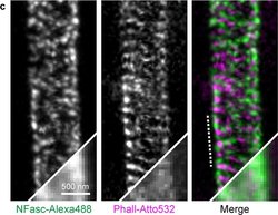 Invitrogen Goat anti-Mouse IgG (H+L) Cross-Adsorbed Secondary Antibody,