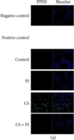 Invitrogen Goat anti-Rabbit IgG (H+L) Cross-Adsorbed Secondary Antibody,