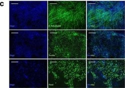 Invitrogen Goat anti-Mouse IgG (H+L) Cross-Adsorbed Secondary Antibody,