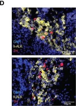 Invitrogen Goat anti-Mouse IgG (H+L) Cross-Adsorbed Secondary Antibody,