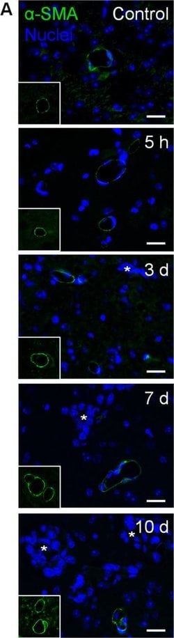 Invitrogen Goat anti-Mouse IgG (H+L) Cross-Adsorbed Secondary Antibody,