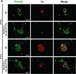Invitrogen F(ab')2-Goat anti-Rabbit IgG (H+L) Cross-Adsorbed Secondary
