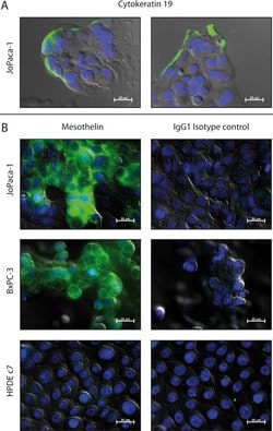 Invitrogen Goat anti-Mouse IgG (H+L) Cross-Adsorbed Secondary Antibody,