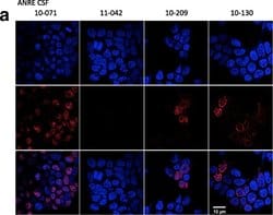 Invitrogen Goat anti-Human IgG (H+L) Cross-Adsorbed Secondary Antibody,