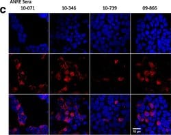 Invitrogen Goat anti-Human IgG (H+L) Cross-Adsorbed Secondary Antibody,