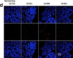 Invitrogen Goat anti-Human IgG (H+L) Cross-Adsorbed Secondary Antibody,