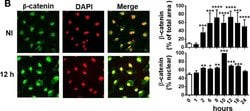 Invitrogen Goat anti-Mouse IgG (H+L) Cross-Adsorbed Secondary Antibody,