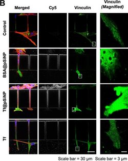 Invitrogen Goat anti-Mouse IgG (H+L) Cross-Adsorbed Secondary Antibody,