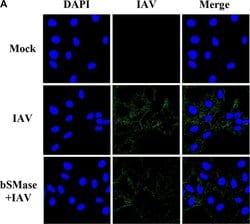 Invitrogen Goat anti-Mouse IgG (H+L) Cross-Adsorbed Secondary Antibody,