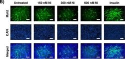 Invitrogen Goat anti-Mouse IgG (H+L) Cross-Adsorbed Secondary Antibody,