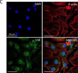 Invitrogen Goat anti-Mouse IgG (H+L) Cross-Adsorbed Secondary Antibody,