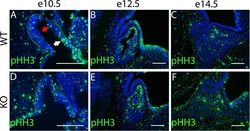 Invitrogen Goat anti-Rabbit IgG (H+L) Cross-Adsorbed Secondary Antibody,