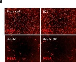 Invitrogen Donkey anti-Sheep IgG (H+L) Cross-Adsorbed Secondary Antibody,