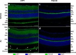 Invitrogen F(ab')2-Goat anti-Rabbit IgG (H+L) Cross-Adsorbed Secondary