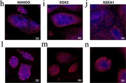 Invitrogen Goat anti-Mouse IgM (Heavy chain) Cross-Adsorbed Secondary Antibody,
