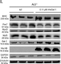 Invitrogen Goat anti-Mouse IgG (H+L) Highly Cross-Adsorbed Secondary Antibody,
