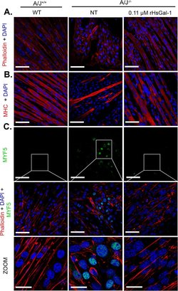 Invitrogen Goat anti-Mouse IgG (H+L) Highly Cross-Adsorbed Secondary Antibody,