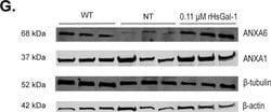 Invitrogen Goat anti-Mouse IgG (H+L) Highly Cross-Adsorbed Secondary Antibody,