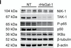 Invitrogen Goat anti-Mouse IgG (H+L) Highly Cross-Adsorbed Secondary Antibody,