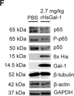 Invitrogen Goat anti-Mouse IgG (H+L) Highly Cross-Adsorbed Secondary Antibody,