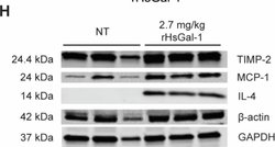 Invitrogen Goat anti-Mouse IgG (H+L) Highly Cross-Adsorbed Secondary Antibody,