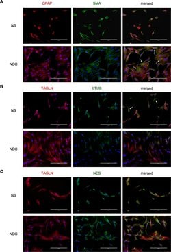 Invitrogen Goat anti-Rabbit IgG (H+L) Cross-Adsorbed Secondary Antibody,