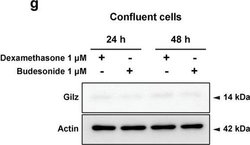 Invitrogen Goat anti-Rat IgG (H+L) Secondary Antibody, HRP, eBioscience
