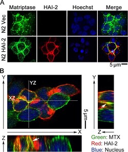 Invitrogen&trade;&nbsp;Goat anti-Rabbit IgG (H+L) Cross-Adsorbed Secondary Antibody, Rhodamine