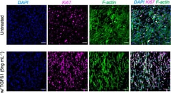 Invitrogen Goat anti-Mouse IgG (H+L) Cross-Adsorbed Secondary Antibody,